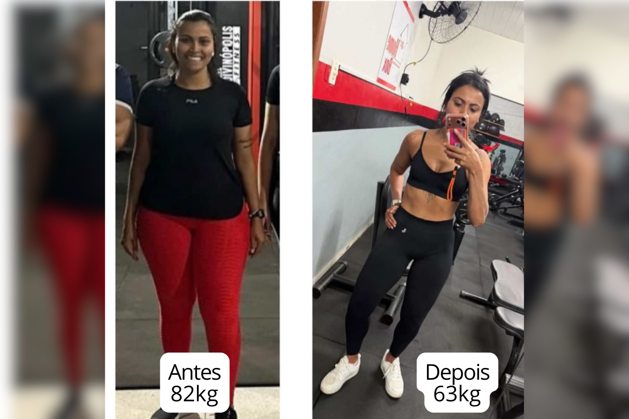 Paciente antes com 82kg e depois com 63kg