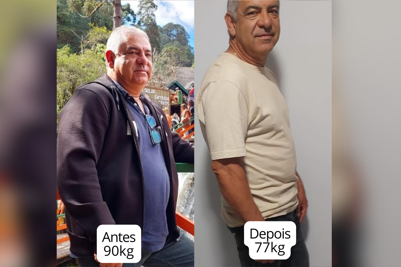 Paciente antes com 90kg e depois com 77kg