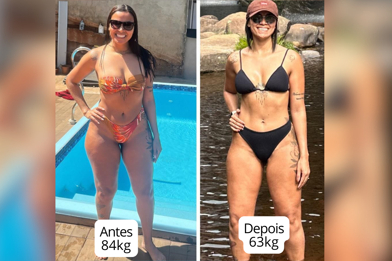Paciente antes com 84kg e depois com 63kg